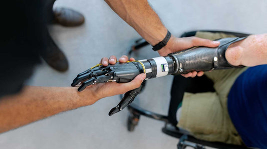 Therapeutic Interventions in Upper Limb Prosthetic Rehabilitation